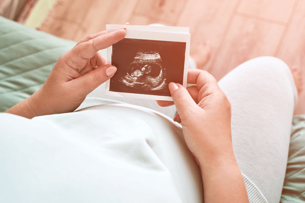 Image of a woman's hands holding an ultrasound photo near her pregnant belly